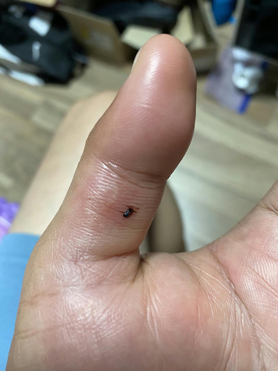 사량도 2번째날...쑤기미에 쏘이다