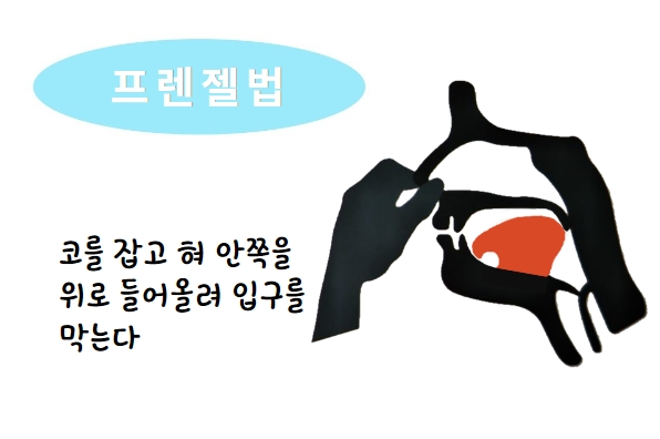 2️⃣ 프렌젤법 (Frenzel Maneuver)