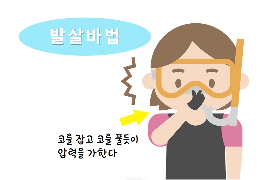 1️⃣  발살바법 (Valsalva Maneuver)