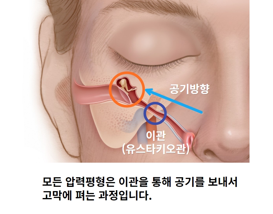 압력평형(이퀄라이징) 알아보기